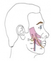 Super-Innervation of a Free Latissimus Dorsi Flap in Facial Reanimation: A Novel Strategy for Supplementing Muscle Innervation