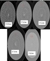 Variation of Noise with Some Scanning Parameters for Image Quality Test in a 128 Slice Computed Tomography Scanner Using Catphan700 Phantom